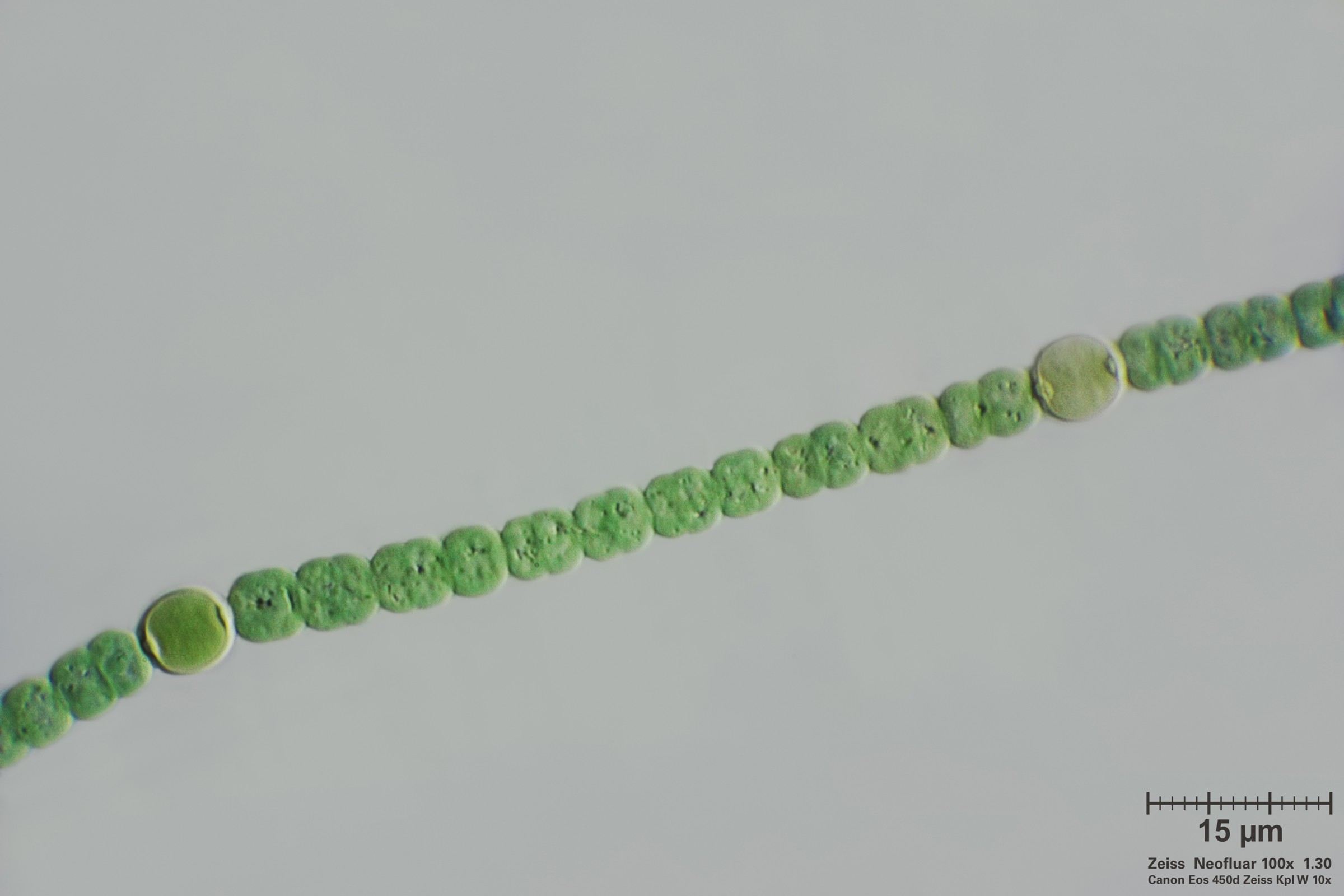 Anabaena